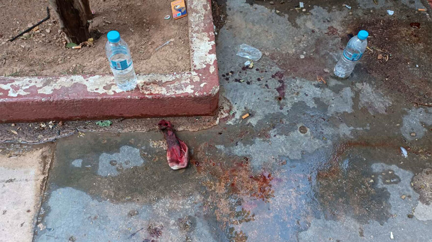 Άγιος Παντελεήμονας: Συνελήφθη ένας από τους εμπλεκόμενους για τον πυροβολισμό του 25χρονου