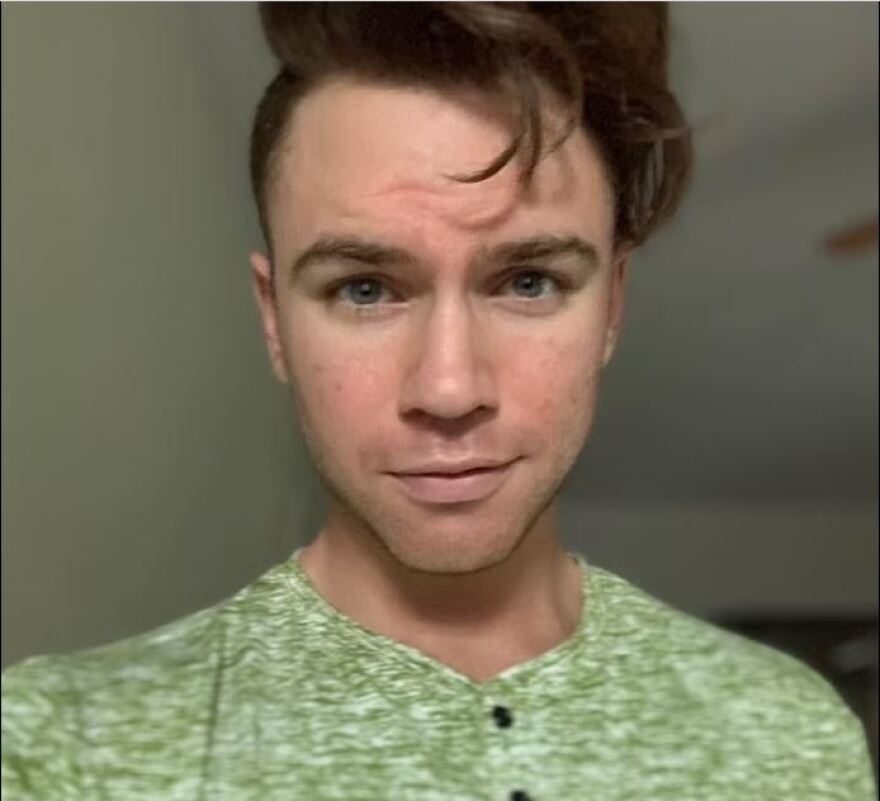 Δωρεά σπέρματος: Γίνεται όλο και πιο δημοφιλής - Οι φόβοι αιμομιξίας, οι νόμοι και οι περιορισμοί