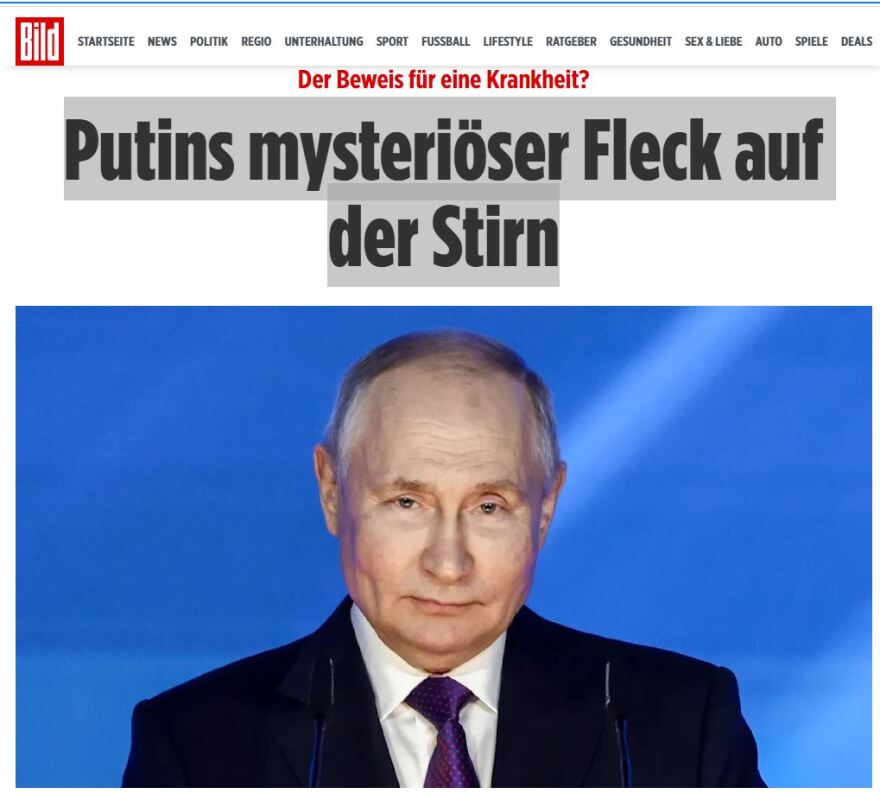 Ρωσία:  Σπαζοκεφαλιά για τους ειδικούς η κηλίδα στο μέτωπο του Πούτιν