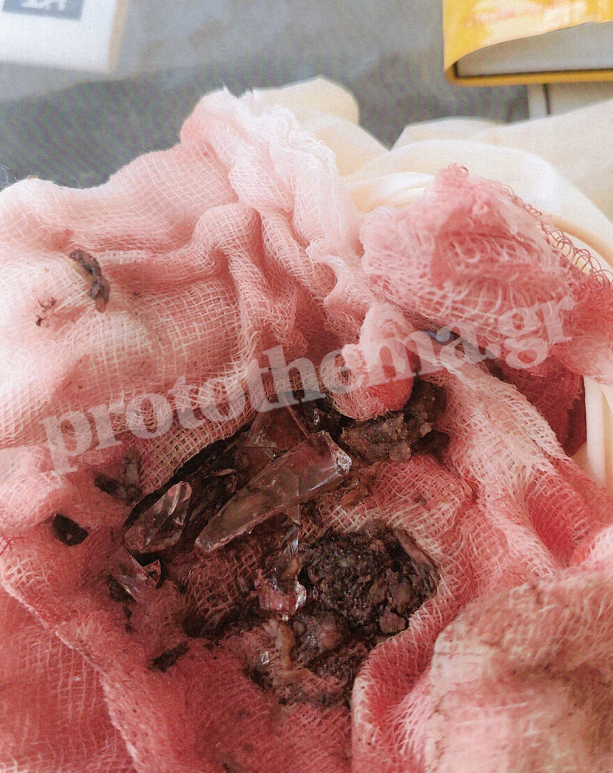 Σεπόλια: Χώρισαν και εκείνος για να την εκδικηθεί έριξε φόλα στον σκύλο της 