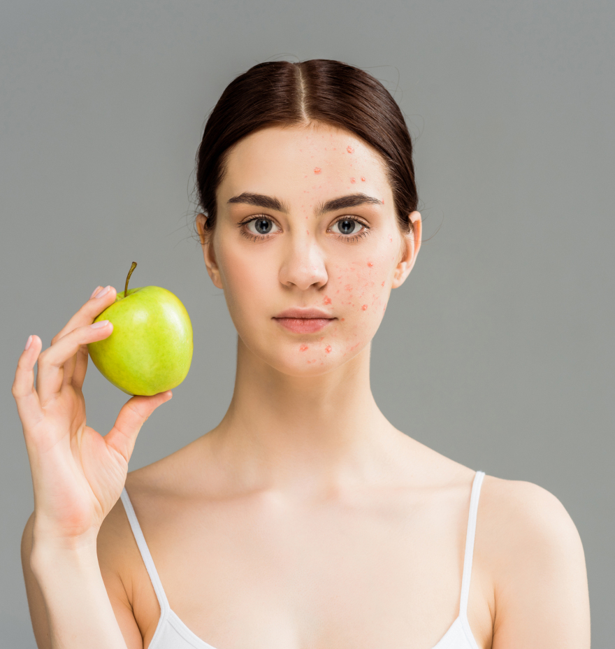 Πώς η διατροφή μας αλλάζει το δέρμα μας: Αλήθειες και μύθοι