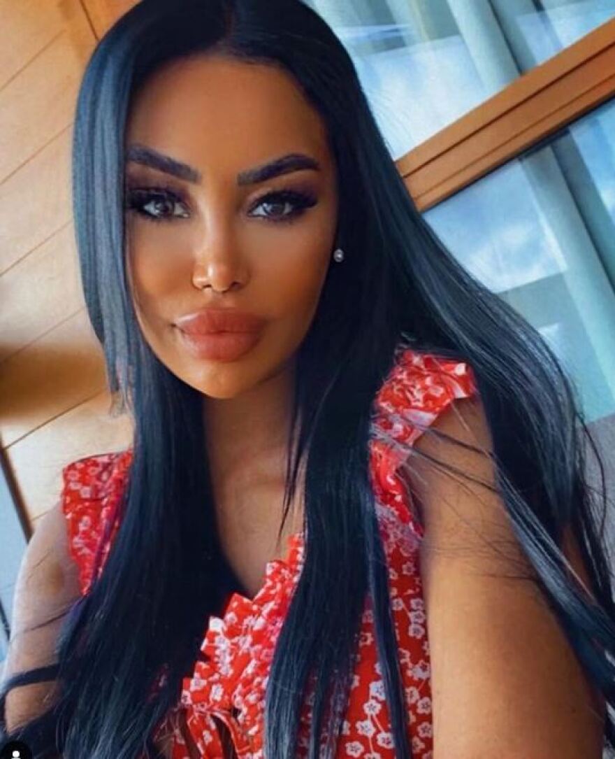 Τάμπι Μπράουν: Πέθανε σε ηλικία 38 ετών το μοντέλο του Playboy και του Cosmopolitan