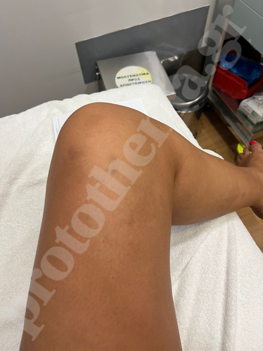 «Με κλωτσούσε δυνατά στην κοιλιά»: Η μήνυση της εγκύου που ξυλοκοπήθηκε από τον επιχειρηματία σύντροφό της