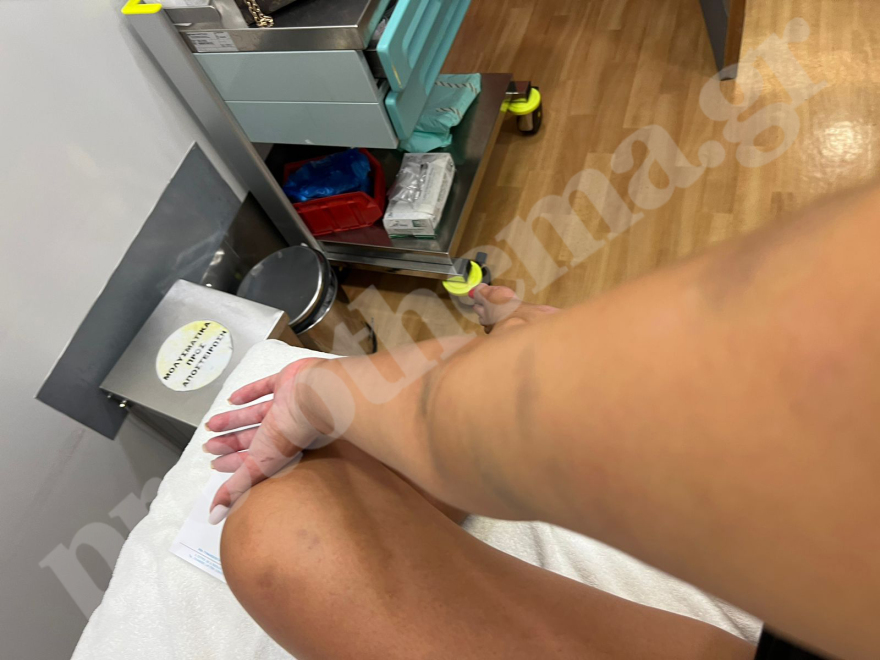 «Με κλωτσούσε δυνατά στην κοιλιά»: Η μήνυση της εγκύου που ξυλοκοπήθηκε από τον επιχειρηματία σύντροφό της