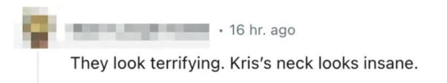 Κλόε Καρντάσιαν: Απογοητευμένοι οι θαυμαστές της με το photoshop στις φωτογραφίες της