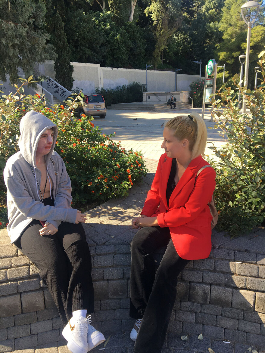 Πήλιο: «Είδα το πρόσωπό μου και ήταν η χειρότερη στιγμή της ζωής μου», λέει η 22χρονη που κάηκε ανάβοντας τη σόμπα