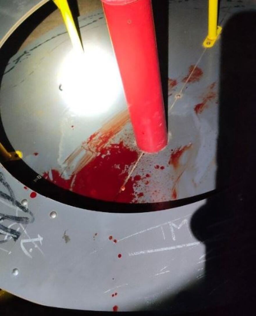 Δεν κινδυνεύει η ζωή της 15χρονης που τραυματίστηκε σε παιδική χαρά στην Αλεξανδρούπολη