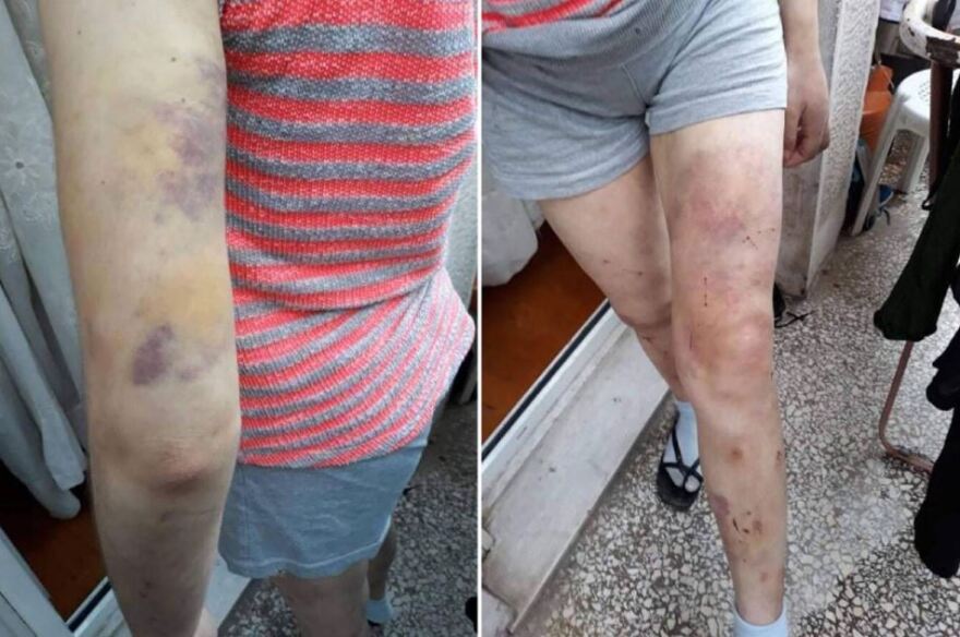 Φαίη Μπακογιώργου: Τα δύο ερωτήματα που θα ρίξουν φως στη δολοφονία της 23χρονης