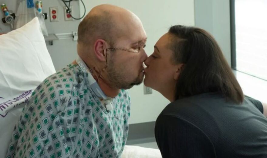 Νέα Υόρκη: Μεταμόσχευσαν για πρώτη φορά με επιτυχία ολόκληρο μάτι σε ασθενή - Δείτε φωτογραφίες