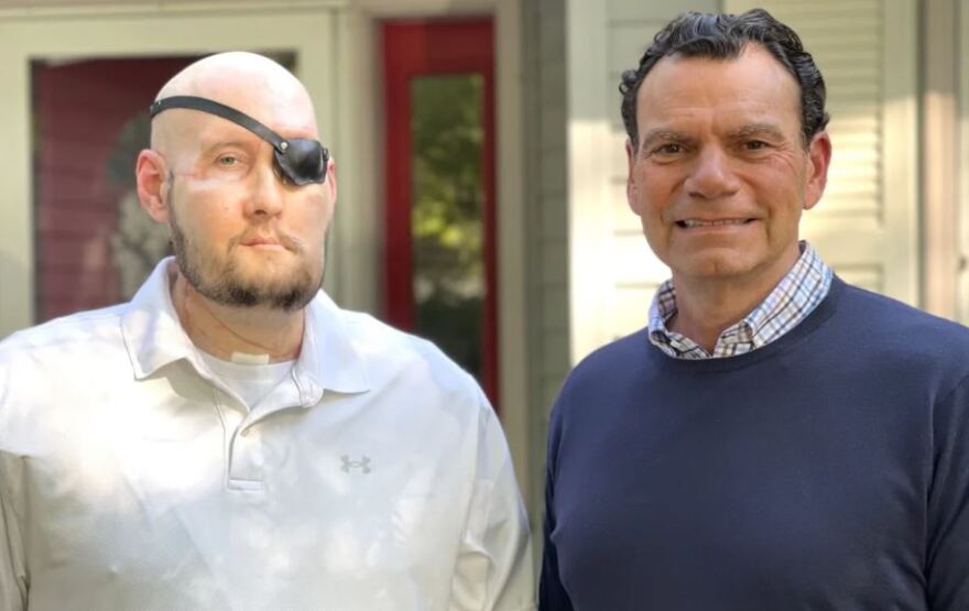 Νέα Υόρκη: Μεταμόσχευσαν για πρώτη φορά με επιτυχία ολόκληρο μάτι σε ασθενή - Δείτε φωτογραφίες