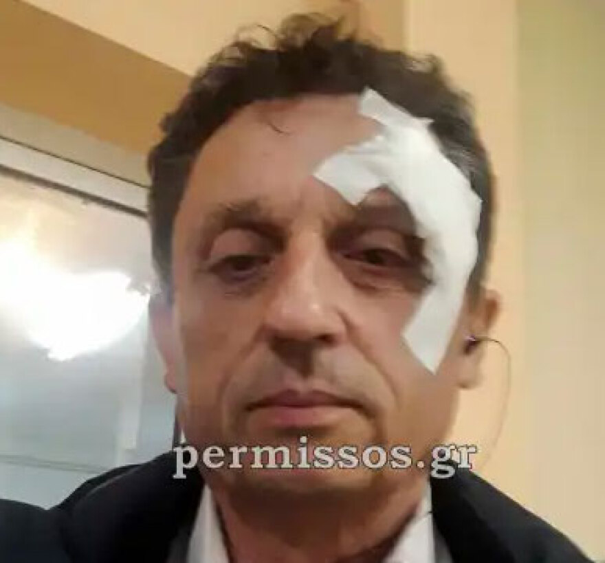 Επεισόδια με Ρομά σε Μέγαρα, Θήβα, Χαλκίδα, Θεσσαλονίκη - Τραυμάτισαν τον δήμαρχο Αλιάρτου