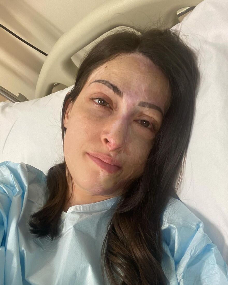 Ιωάννα Παλιοσπύρου: Η αποκάλυψή της για το χειρουργείο που θα κάνει σε λίγο καιρό