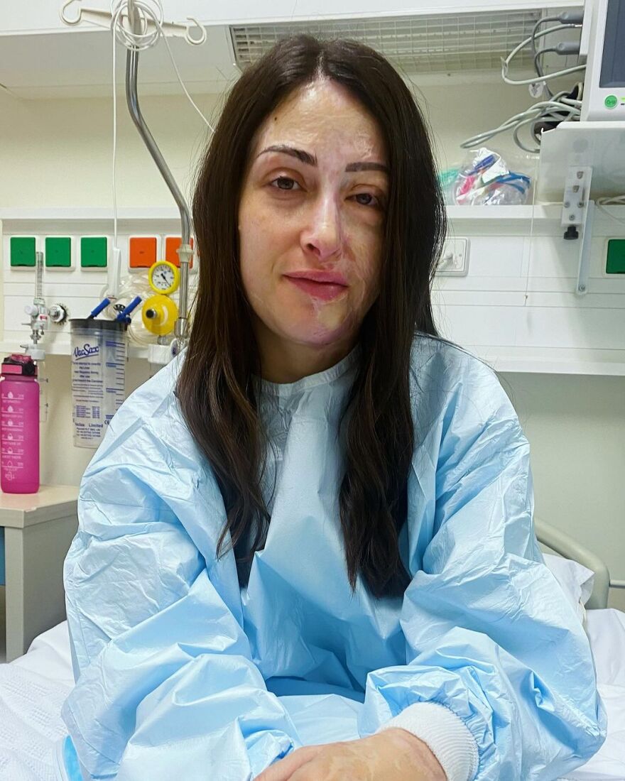 Ιωάννα Παλιοσπύρου: Η αποκάλυψή της για το χειρουργείο που θα κάνει σε λίγο καιρό