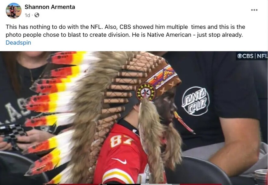 Άγριο bullying σε 5χρονο στις ΗΠΑ: Νόμιζαν πως έκανε blackface αλλά τελικά είχε βαφτεί στα χρώματα της ομάδας του!