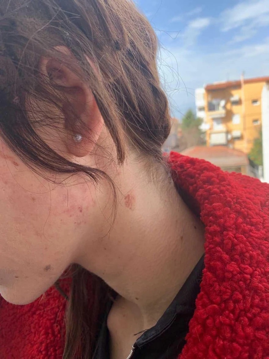 Μαρία Αλεξάνδρου: «Ήταν ένας πραγματικός εφιάλτης» - Τι είχε δηλώσει για τον βασανισμό της από την ιδιοκτήτρια του κέντρου αισθητικής στη Θεσσαλονίκη