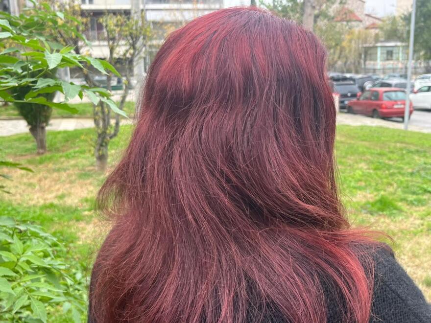 «Με χτυπούσε άλλα φοβόμουν να φύγω γιατί με απειλούσε» - Συγκλονίζει η γυναίκα που έπεσε θύμα ξυλοδαρμού από τον πρώην σύντροφό της