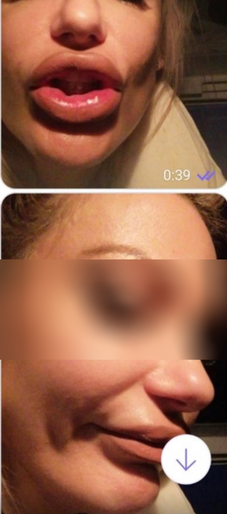 Το ινστιτούτο της απάτης: Τους κατέστρεφαν τα πρόσωπα με «μαϊμού» μπότοξ - Στο φως τρεις νέες δικογραφίες