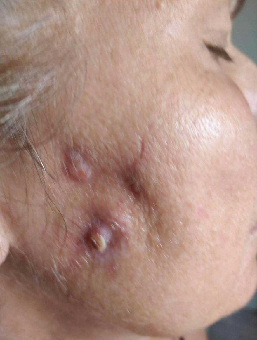 Το ινστιτούτο της απάτης: Τους κατέστρεφαν τα πρόσωπα με «μαϊμού» μπότοξ - Στο φως τρεις νέες δικογραφίες