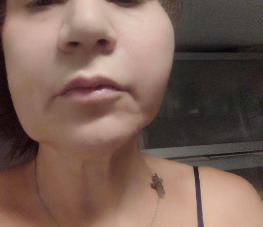 Το ινστιτούτο της απάτης: Τους κατέστρεφαν τα πρόσωπα με «μαϊμού» μπότοξ - Στο φως τρεις νέες δικογραφίες