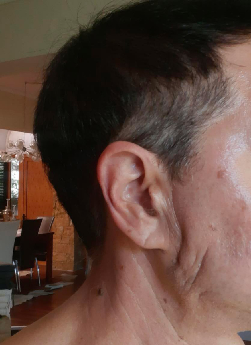 Το ινστιτούτο της απάτης: Τους κατέστρεφαν τα πρόσωπα με «μαϊμού» μπότοξ - Στο φως τρεις νέες δικογραφίες