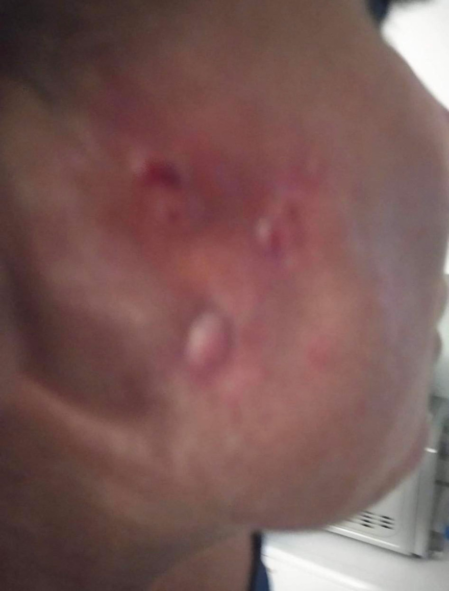 Το ινστιτούτο της απάτης: Τους κατέστρεφαν τα πρόσωπα με «μαϊμού» μπότοξ - Στο φως τρεις νέες δικογραφίες