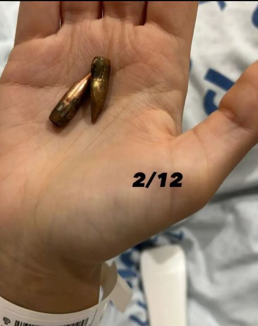 Πόλεμος στο Ισραήλ: Η στρατιωτίνα που έζησε από θαύμα - Δέχτηκε 12 σφαίρες, αλλά προσποιήθηκε τη νεκρή 