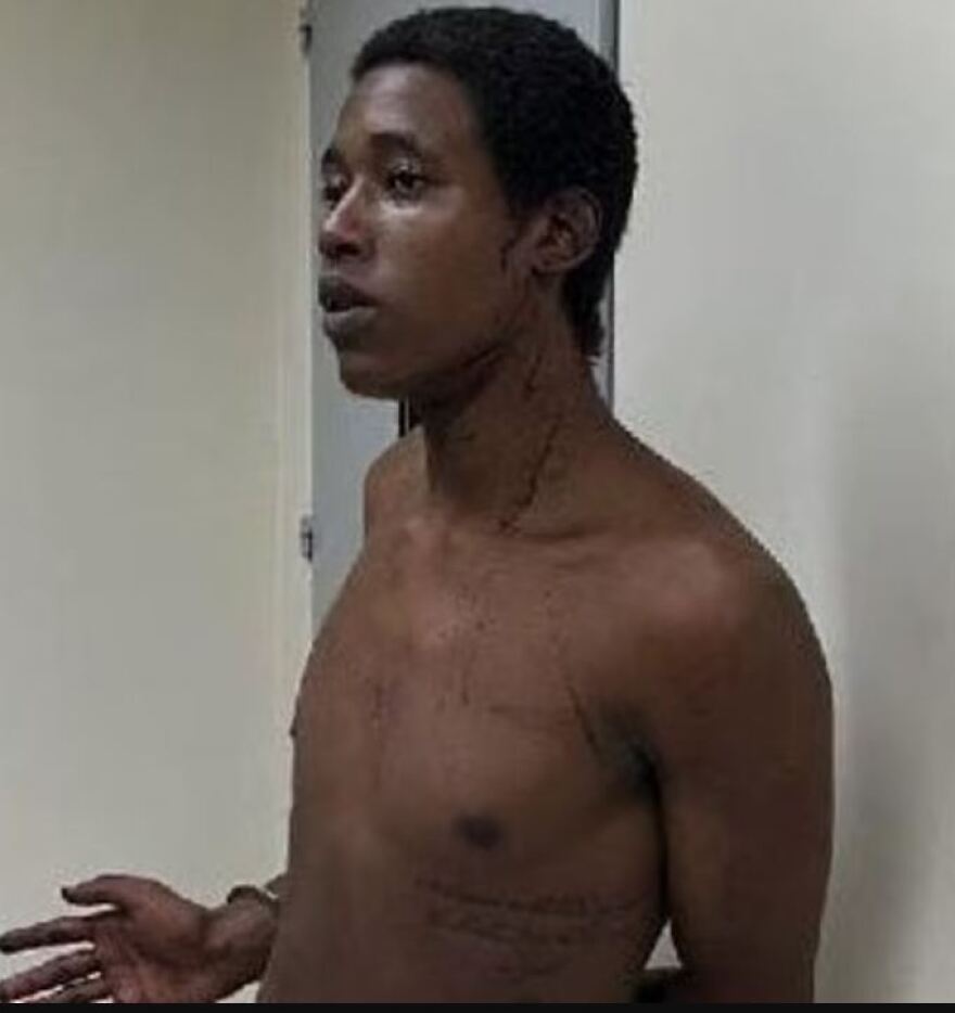 Βραζιλία: Αδιανόητο έγκλημα - Κρέμασε την 4χρονη ανιψιά του επειδή έκλαιγε αφού τη βίασε!