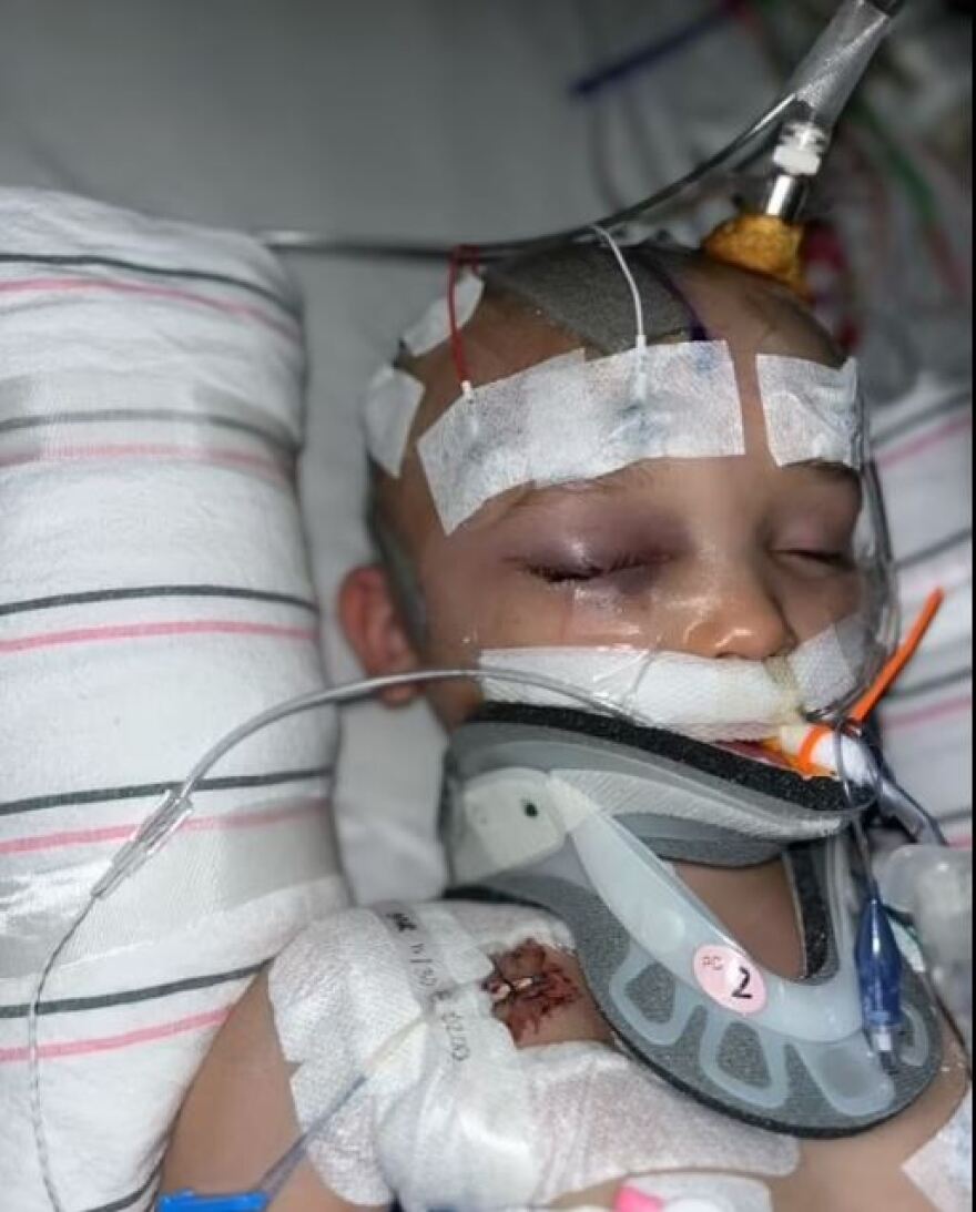 ΗΠΑ: Μπέιμπι σίτερ 12 ετών ξυλοκόπησε με ζώνη 3χρονο που χαροπαλεύει στην εντατική -Σκληρές εικόνες