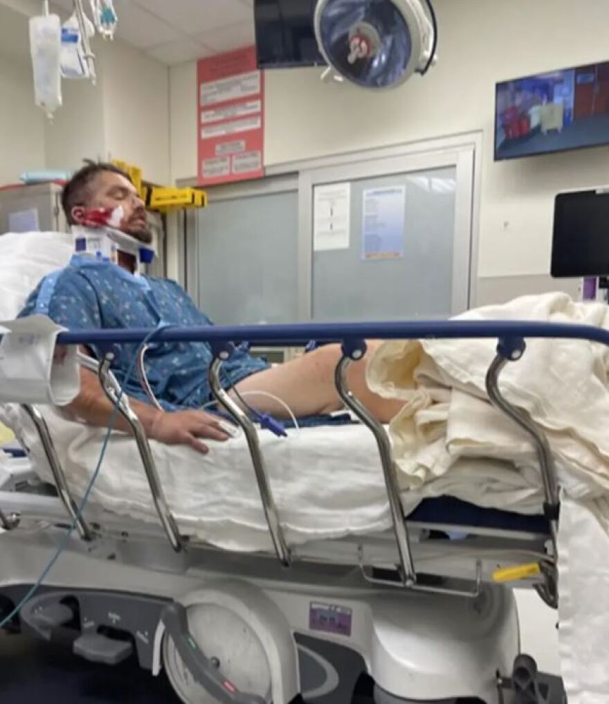 ΗΠΑ: Εκτοξευτής πυραύλων έσκασε στο πρόσωπο YouTuber - Έπαθε κατάγματα στο κρανίο και εγκαύματα