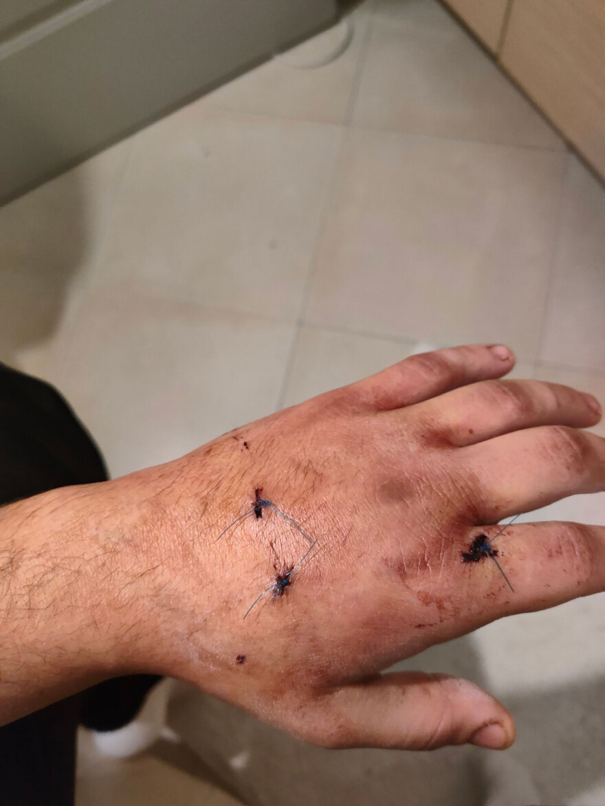 Eγκληματικότητα ανηλίκων: Οι συμμορίες που κάνουν επιθέσεις με σφυριά και τσεκούρια με την πρόφαση περί οπαδικών διαφορών 