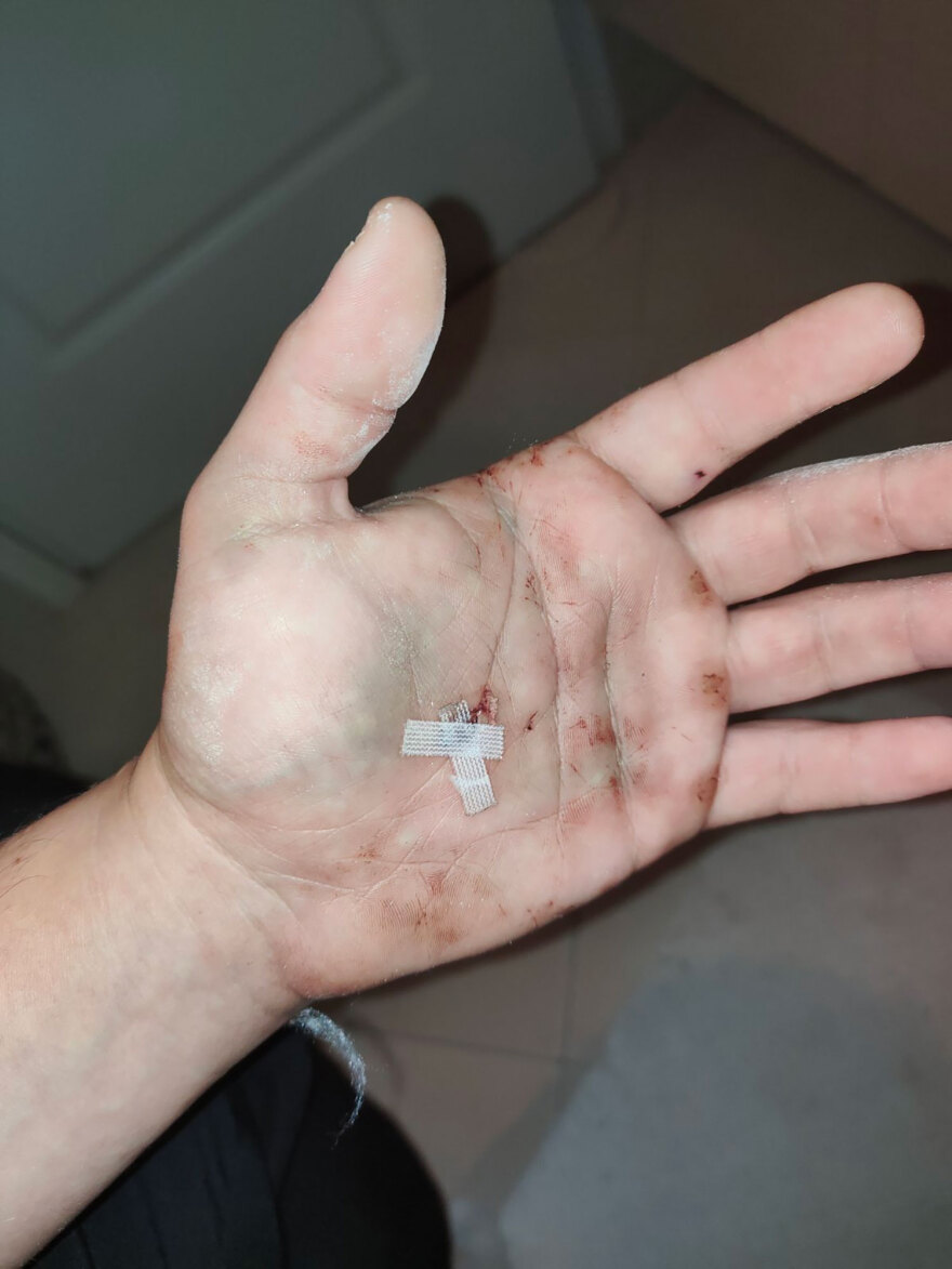 Eγκληματικότητα ανηλίκων: Οι συμμορίες που κάνουν επιθέσεις με σφυριά και τσεκούρια με την πρόφαση περί οπαδικών διαφορών 