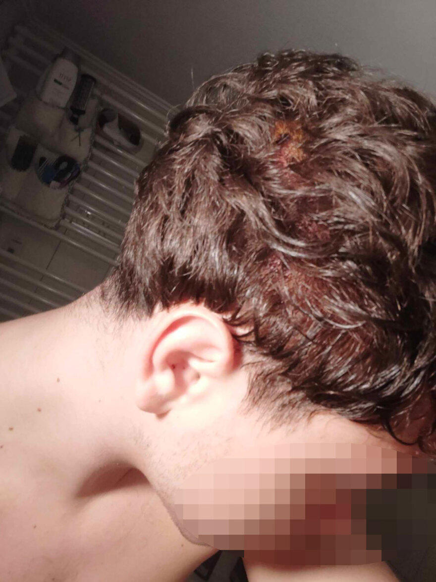 Eγκληματικότητα ανηλίκων: Οι συμμορίες που κάνουν επιθέσεις με σφυριά και τσεκούρια με την πρόφαση περί οπαδικών διαφορών 