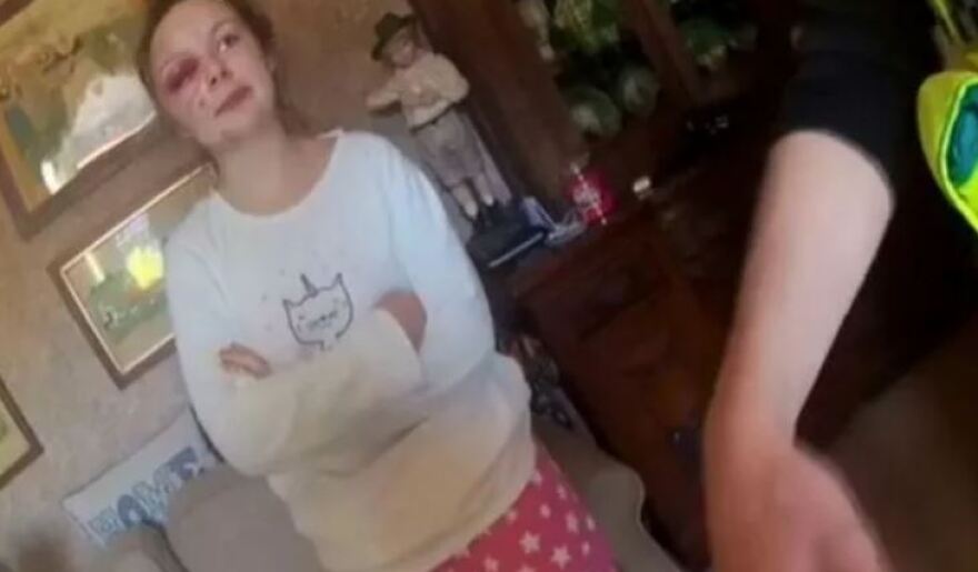 Βρετανίδα παρίστανε για χρόνια το θύμα trafficking και βιασμών - Αυτοτραυματίστηκε με σφυρί για να... πείσει