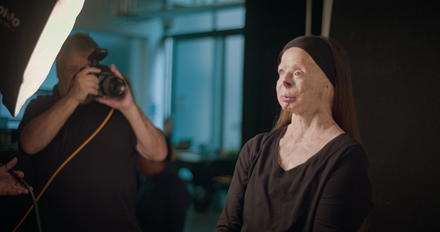 Βρετανός φωτογράφος δημιούργησε λεύκωμα - οδηγό μόδας με μοντέλο συγγραφέα που επέζησε επίθεσης με βιτριόλι