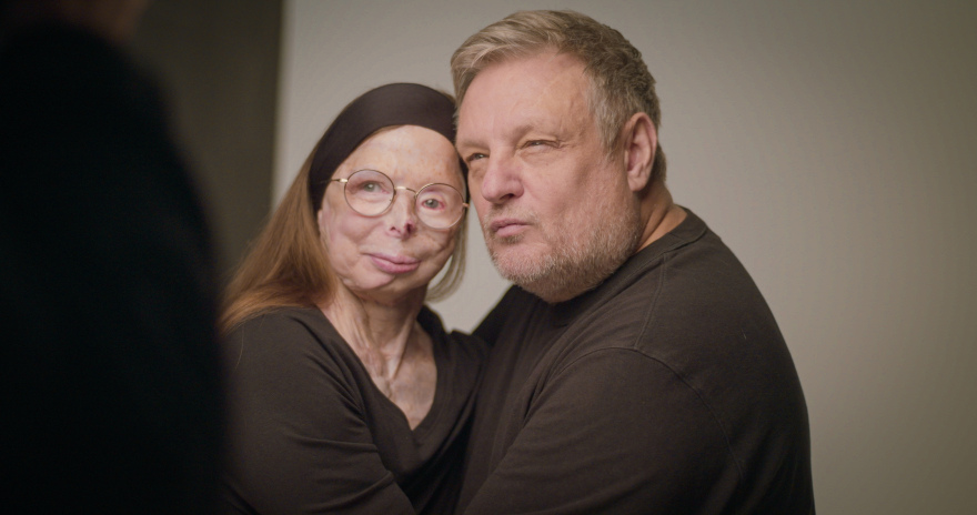 Βρετανός φωτογράφος δημιούργησε λεύκωμα - οδηγό μόδας με μοντέλο συγγραφέα που επέζησε επίθεσης με βιτριόλι