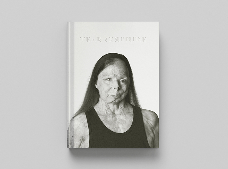 Βρετανός φωτογράφος δημιούργησε λεύκωμα - οδηγό μόδας με μοντέλο συγγραφέα που επέζησε επίθεσης με βιτριόλι