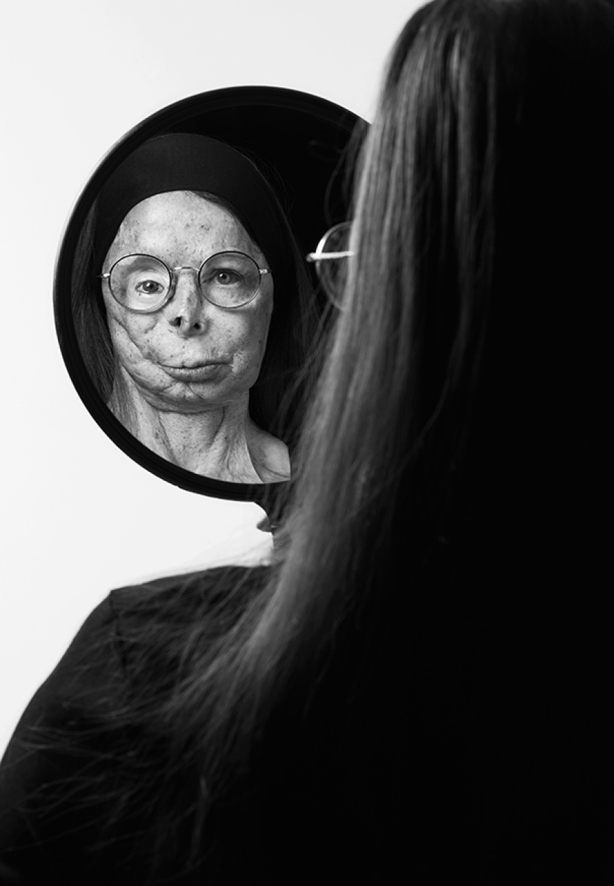 Βρετανός φωτογράφος δημιούργησε λεύκωμα - οδηγό μόδας με μοντέλο συγγραφέα που επέζησε επίθεσης με βιτριόλι