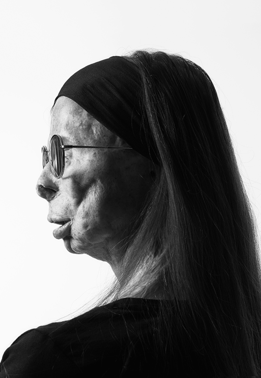 Βρετανός φωτογράφος δημιούργησε λεύκωμα - οδηγό μόδας με μοντέλο συγγραφέα που επέζησε επίθεσης με βιτριόλι