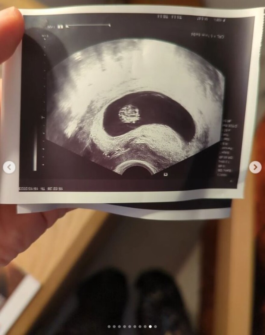 Ντάνη Γιαννακοπούλου: Έγκυος η ηθοποιός