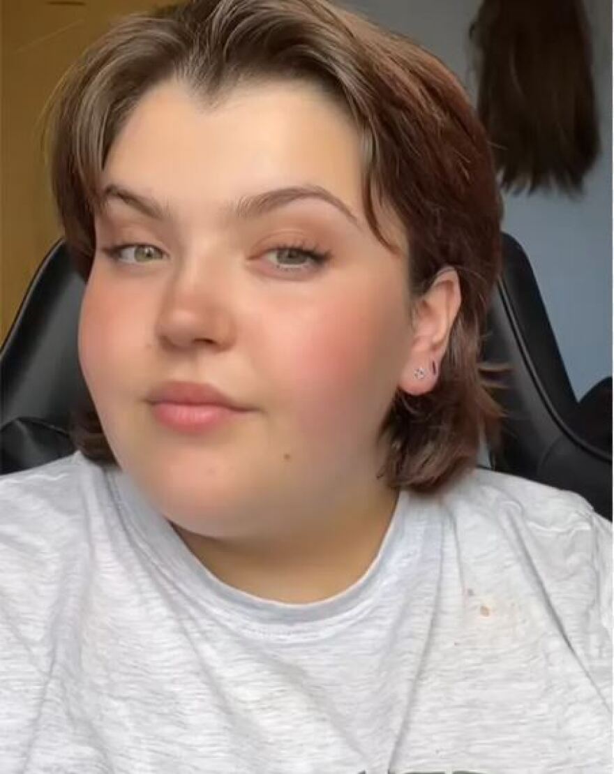 Τούρκος γιατρός τοποθέτησε γαστρικό δακτύλιο σε Βρετανίδα η οποία πέθανε λίγα 24ωρα μετά