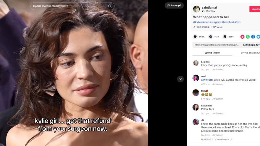 Κάιλι Τζένερ: Σάλος στο Twitter με το πρόσωπό της - Είναι 26 και μοιάζει με 40, γράφουν