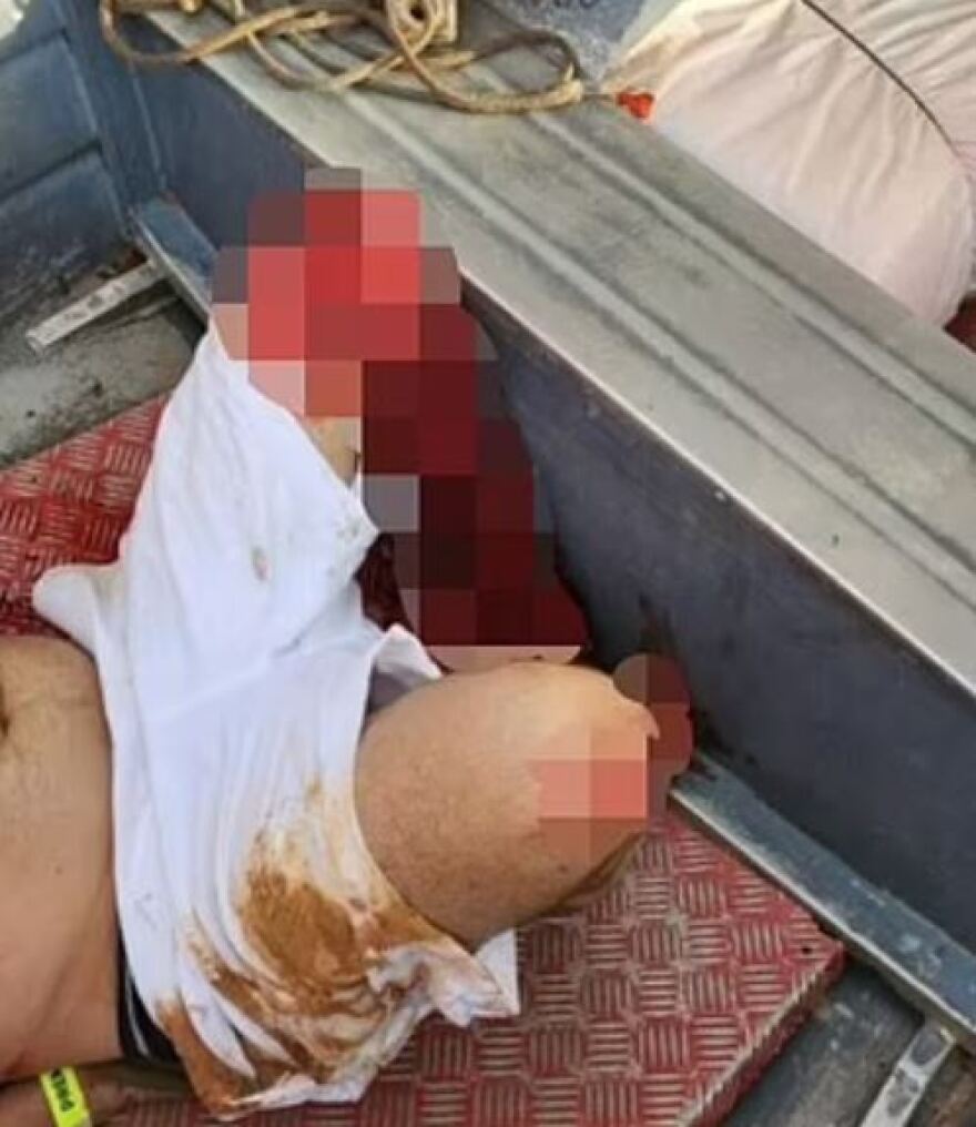 Βραζιλία: Τρομακτικό βίντεο από τη στιγμή που επιβάτης πλοίου κάνει επικίνδυνο άλμα, πέφτει και χάνει το αριστερό του πόδι