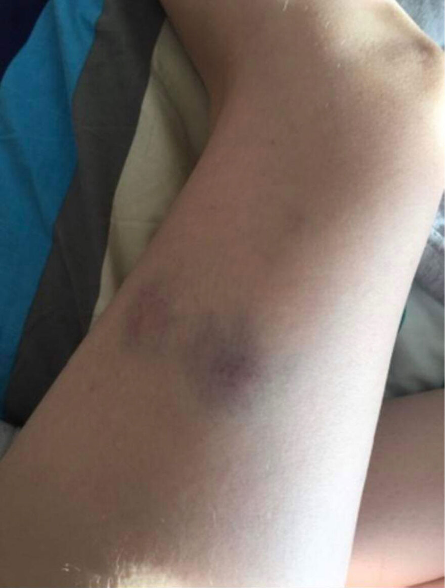 Ντελιβεράς στη Θεσσαλονίκη ξυλοκόπησε την πρώην σύντροφό του και μητέρα του βρέφους του -  «Θόλωσα» είπε στους αστυνομικούς