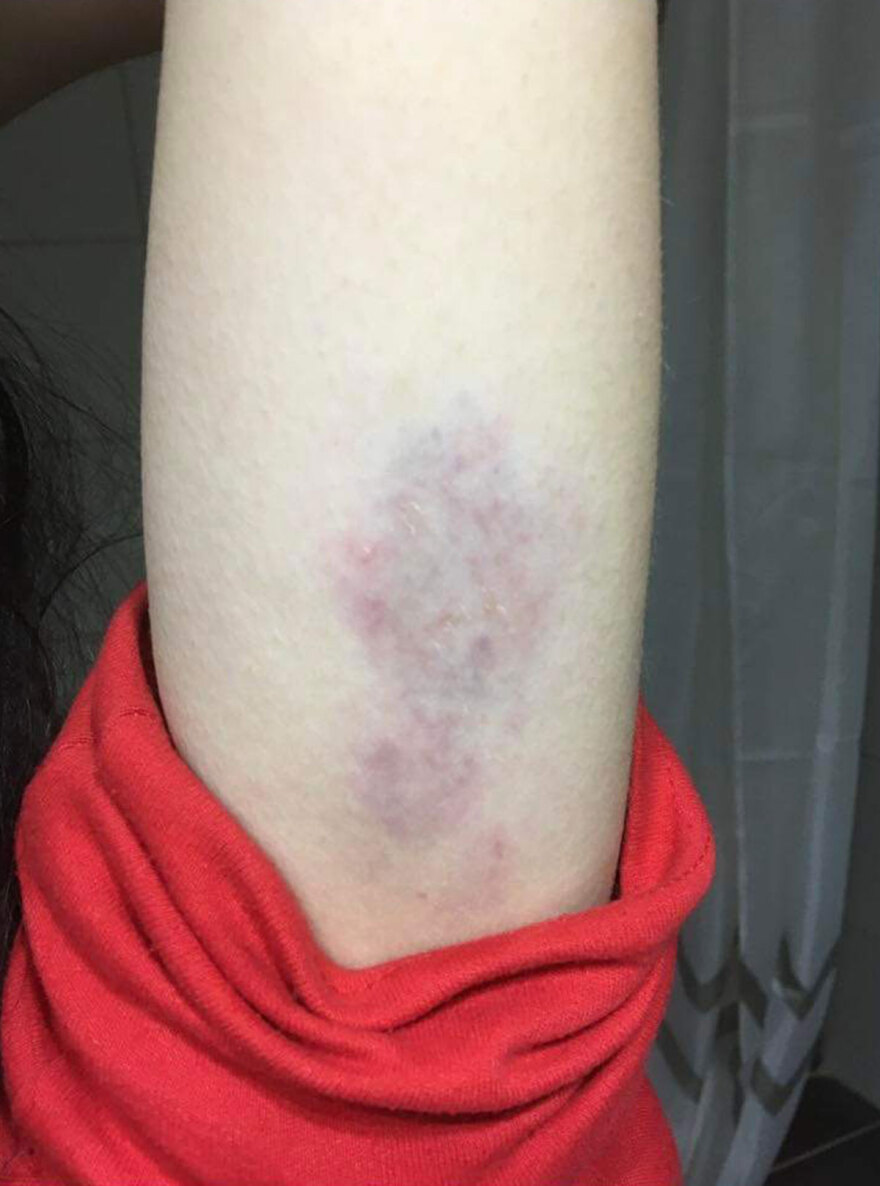 Ντελιβεράς στη Θεσσαλονίκη ξυλοκόπησε την πρώην σύντροφό του και μητέρα του βρέφους του -  «Θόλωσα» είπε στους αστυνομικούς