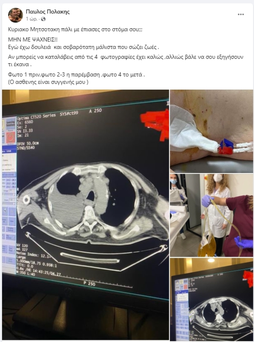 ΣΥΡΙΖΑ: Ώρα κυρώσεων μετά τις αποχές Πολάκη, Ηλιόπουλου και το «παρών» της Κασιμάτη - Τα πιθανά σενάρια