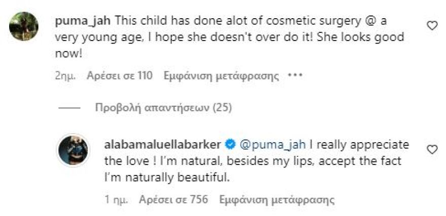 Τράβις Μπάρκερ: Η 18χρονη κόρη του απαντά αν έχει κάνει πλαστικές επεμβάσεις - Αποδεχτείτε ότι είμαι φυσικά όμορφη, γράφει