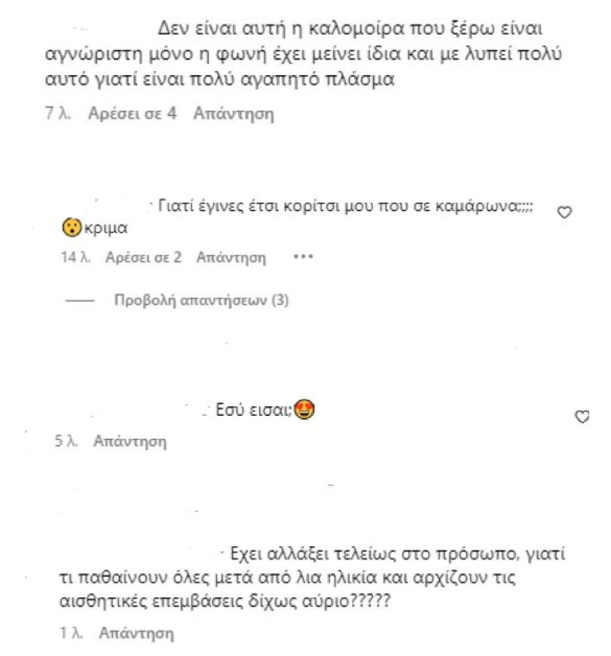 Καλομοίρα: Τα... 1.000 πρόσωπα της τραγουδίστριας - Από το φρέσκο κορίτσι της Eurovision στα μπότοξ και τα fillers