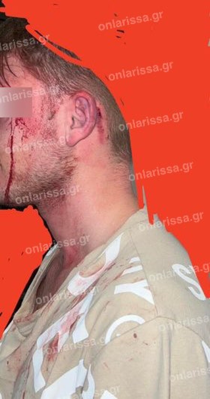 Λάρισα: Βίντεο από άγριο ξυλοδαρμό νεαρού από ομάδα αγνώστων - Τον πέταξαν πάνω σε κάγκελα