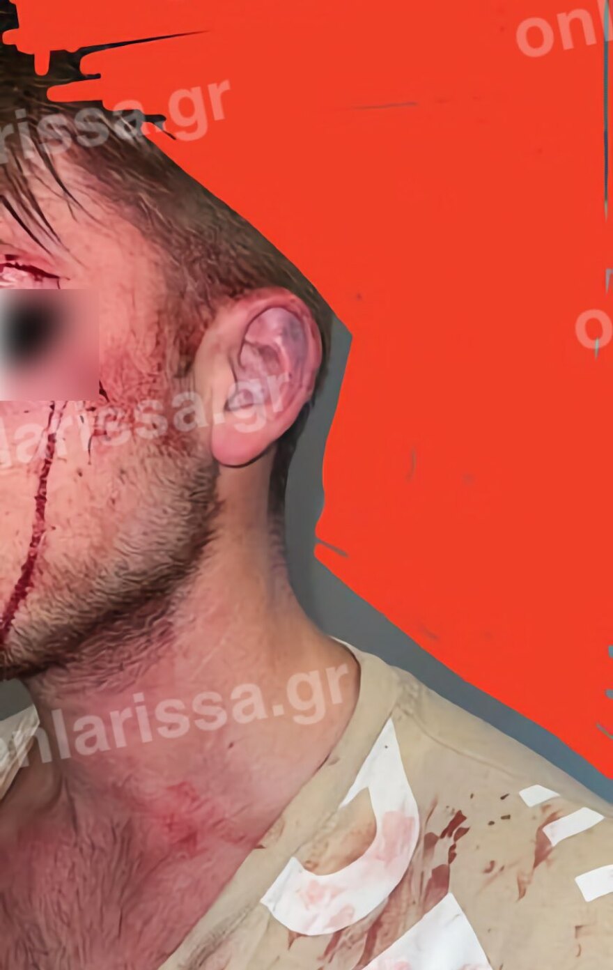 Λάρισα: Βίντεο από άγριο ξυλοδαρμό νεαρού από ομάδα αγνώστων - Τον πέταξαν πάνω σε κάγκελα