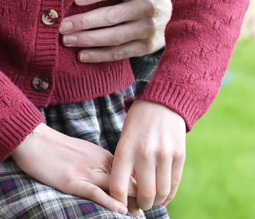 Κέιτ Μίντλετον: Associated Press, Reuters, Getty και Γαλλικό Πρακτορείο αποσύρουν ως «πειραγμένη» την πρώτη φωτογραφία μετά το χειρουργείο